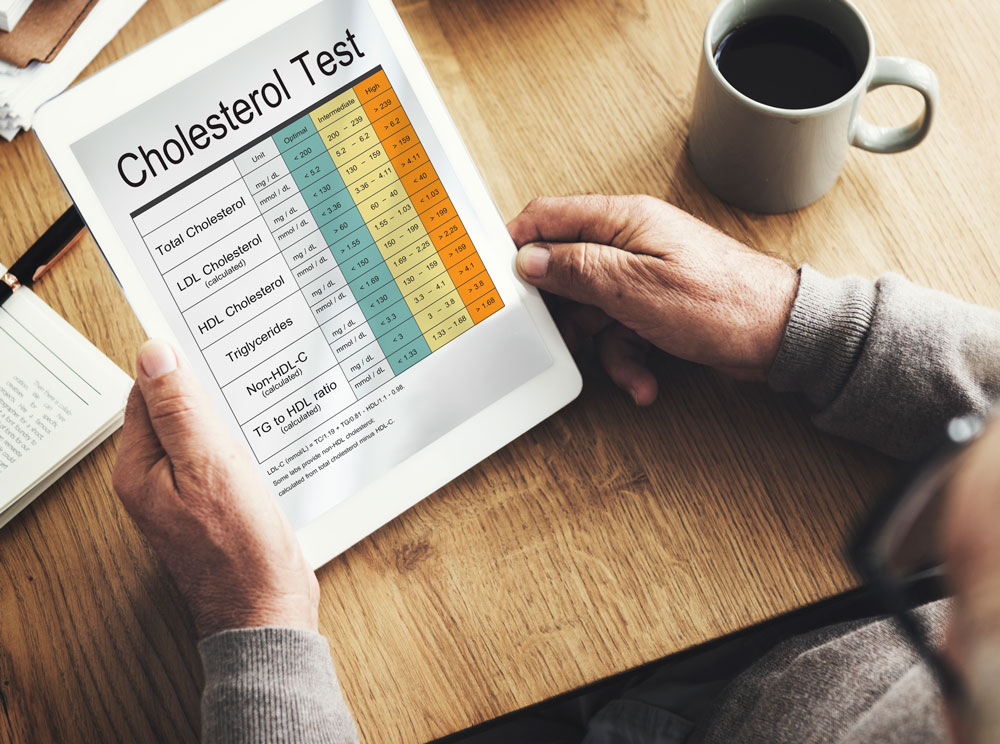 Blood cholesterol report test healthcare 