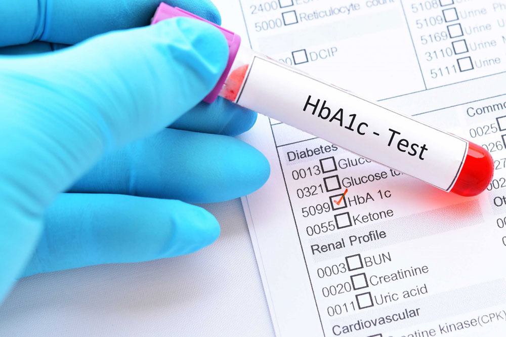 糖尿病診斷：HbA1c檢測