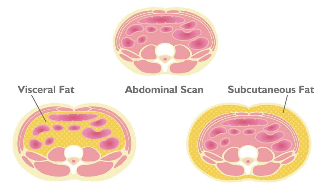 Visceral Fat vs Subcutaneous Fat: Peak Metabolism