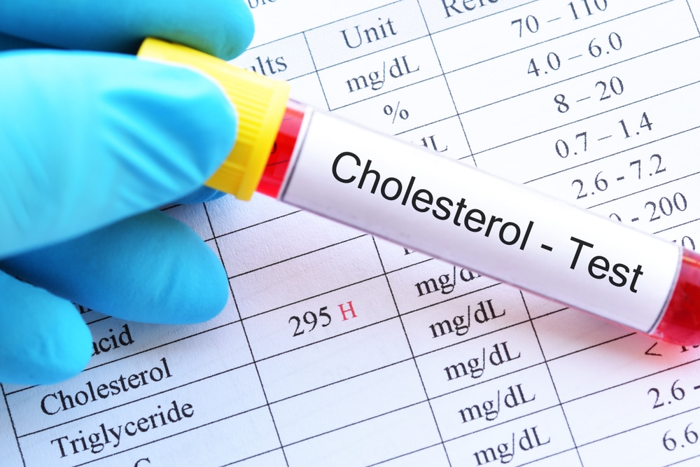 LDL Cholesterol Test Hong Kong