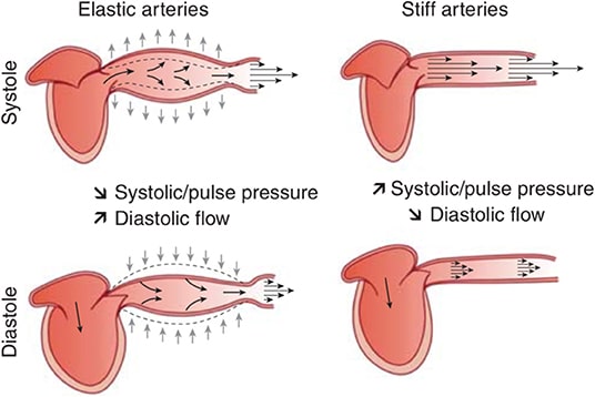 What Causes Arterial Stiffness?